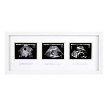 Amazon  Baby Ultrasound Triple Sonogram Pregnancy Frame for Expecting Parents Baby Shower Frame Gender Reveal Party